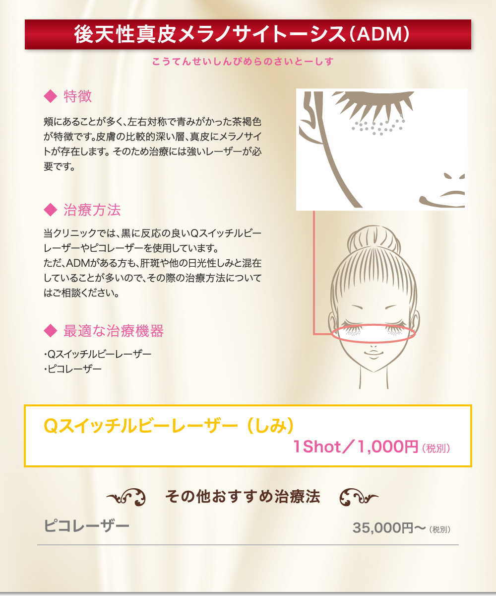 後天性真皮メラノサイトーシス（ADM）