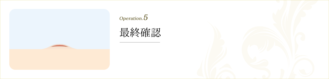operation.5 最終確認