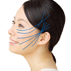 アンカーリフト